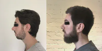 img/1971_beard-styles-to-make-a-weak-jawline-disappear.webp