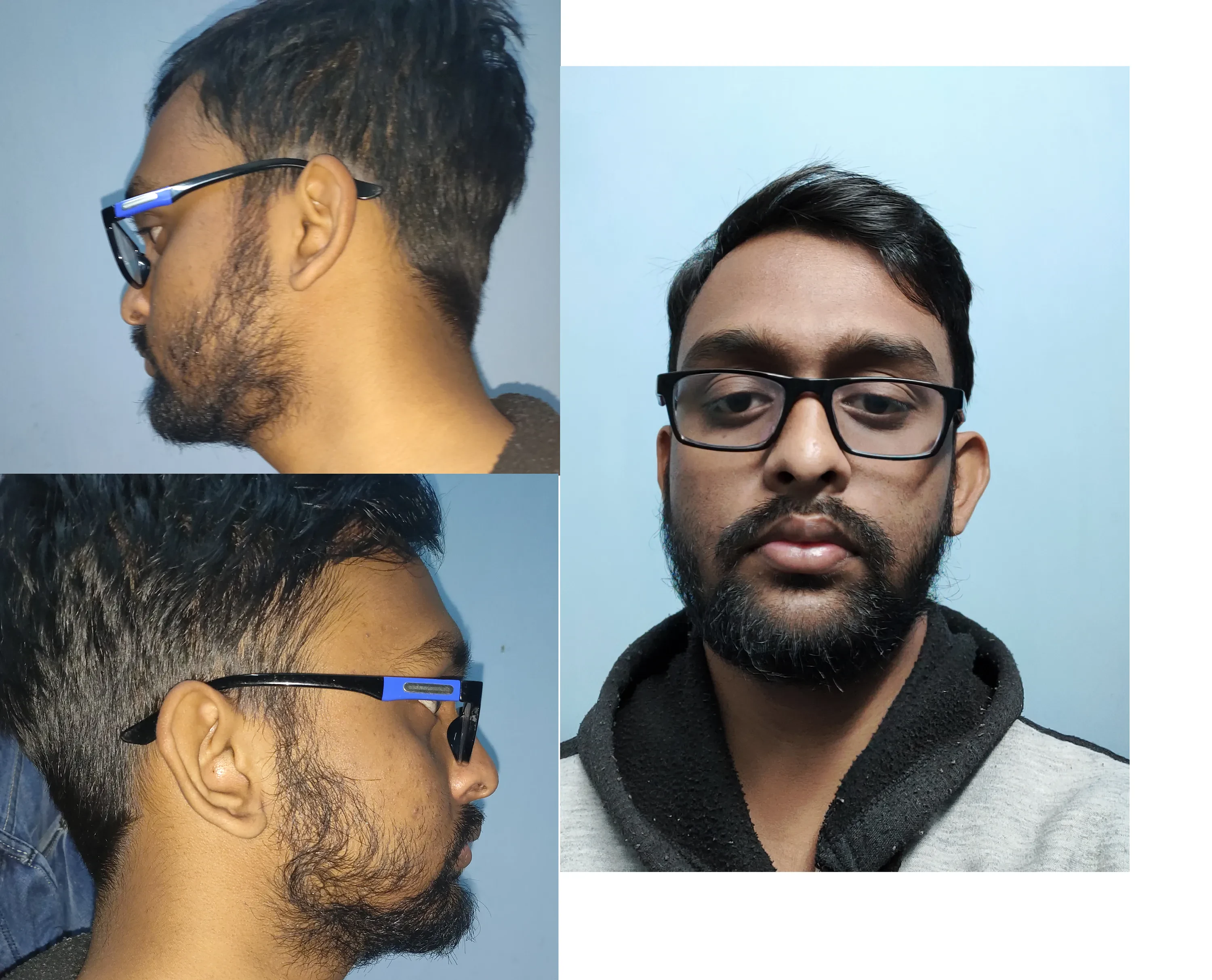 img/1985_rocking-a-10mm-beard-the-ultimate-guide.webp