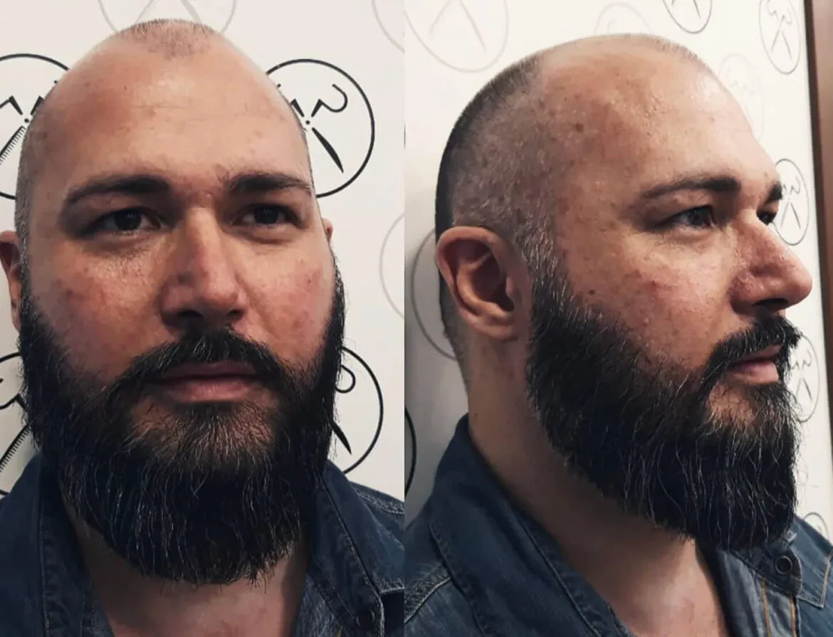 Short rounded beard 2024