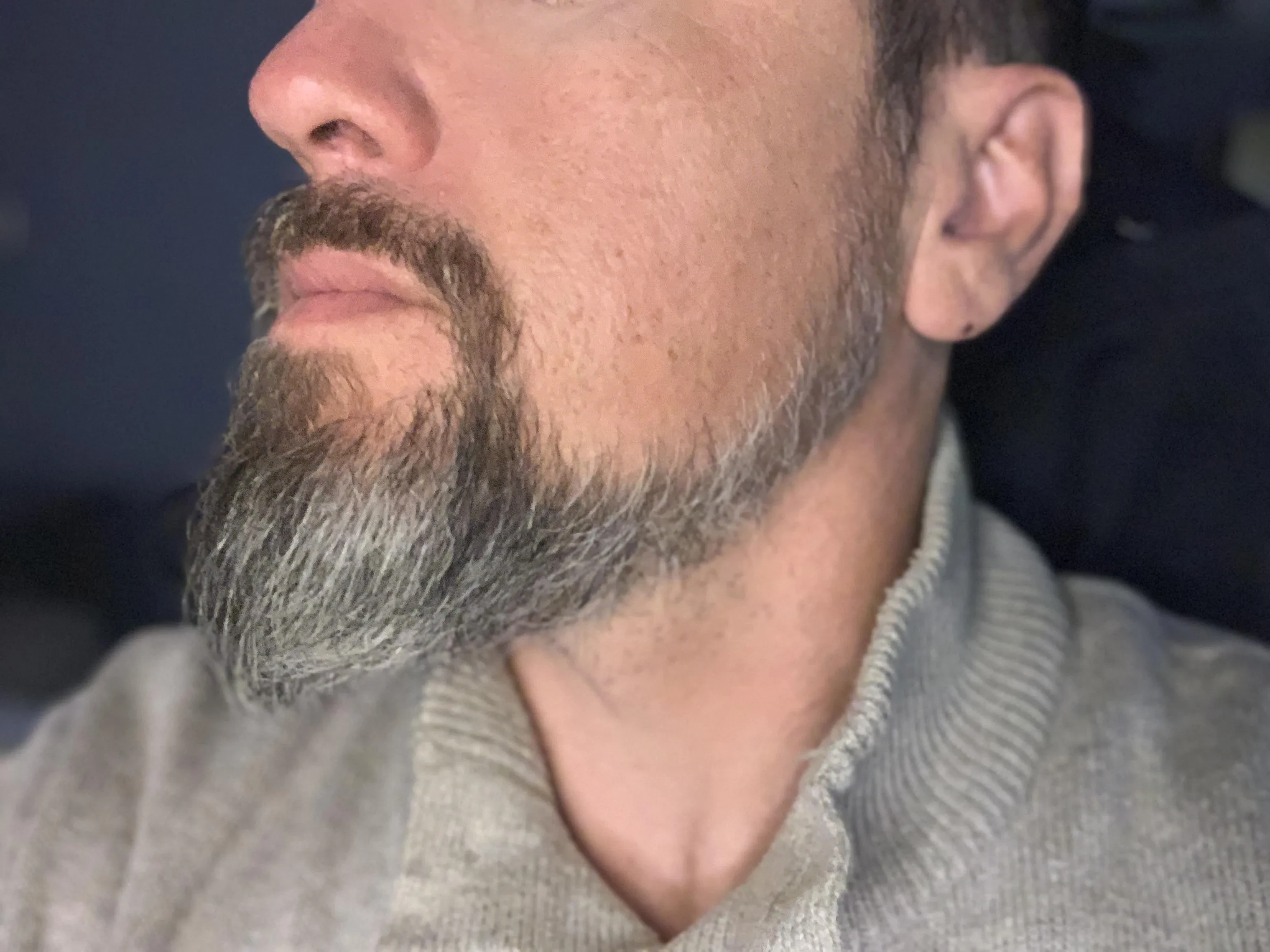 chin strap beard